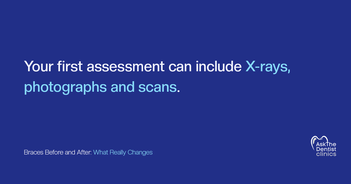 Your first braces assessment can include X-rays, photographs and scans