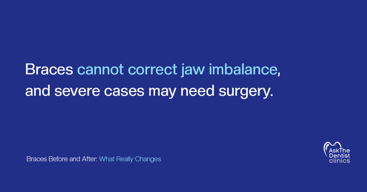 Braces cannot correct jaw imbalance, and severe cases may need surgery