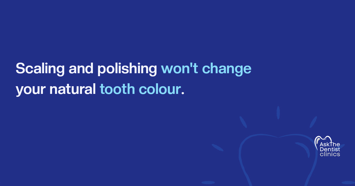 Scaling and polishing will not change your natural tooth colour
