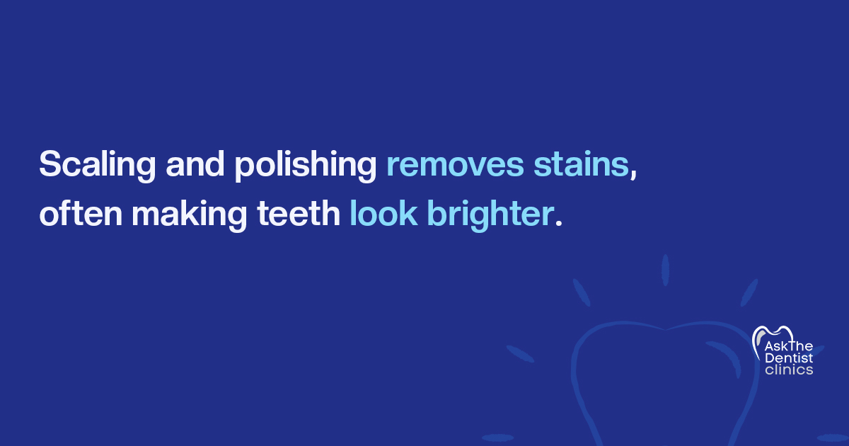 Scaling and polishing removes stains, often making teeth look brighter