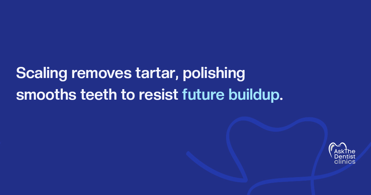 Scaling removes tartar and polishing smooths teeth to resist future buildup