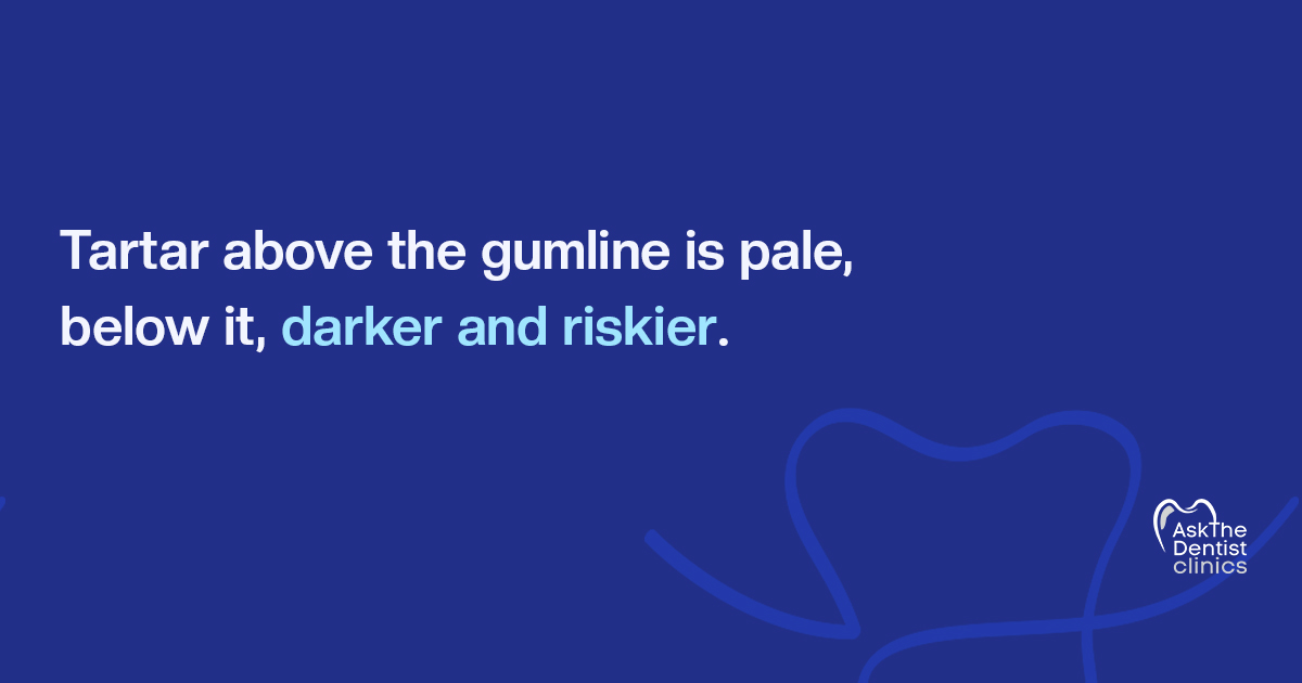 Tartar above the gumline is pale, below it is darker and riskier