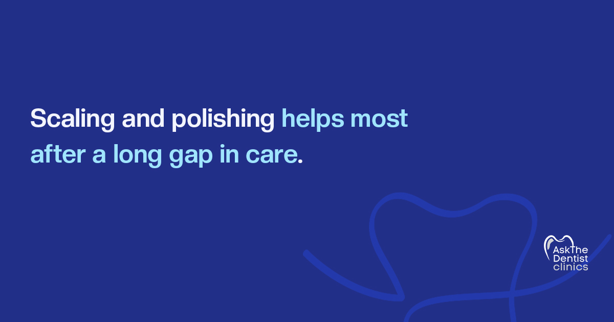 Scaling and polishing helps most after a long gap in care