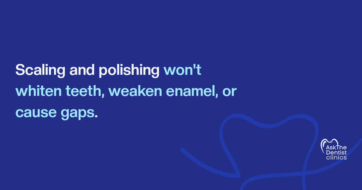 Scaling and polishing will not whiten teeth, weaken enamel or cause gaps