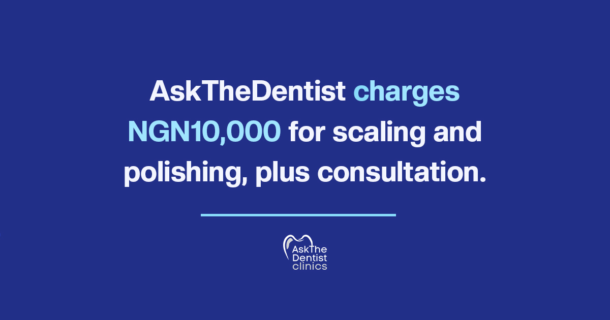 AskTheDentist charges NGN10,000 for scaling and polishing, plus consultation