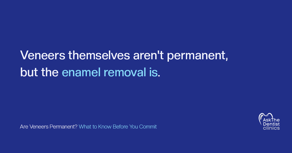 Veneers themselves aren't permanent, but the enamel removal is
