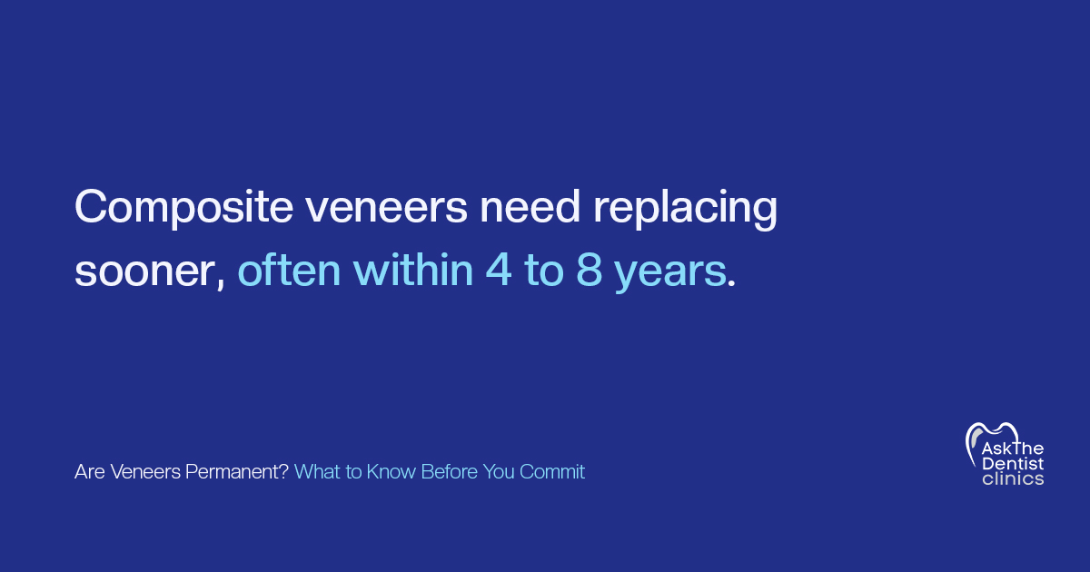 Composite veneers need replacing sooner, often within 4 to 8 years