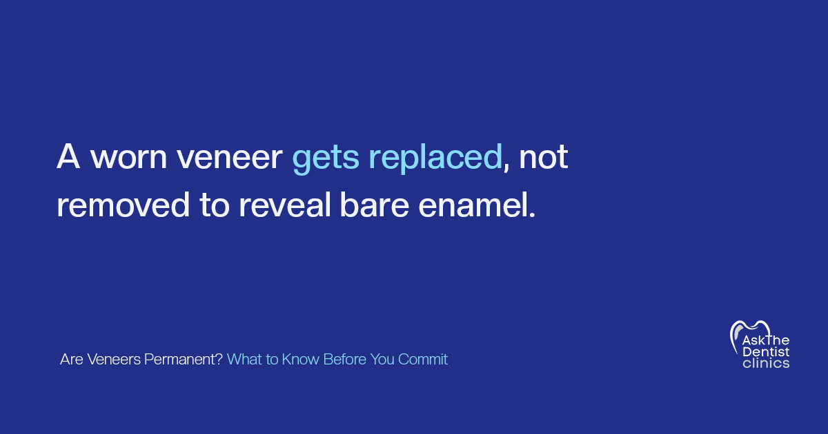 A worn veneer gets replaced, not removed to reveal bare enamel