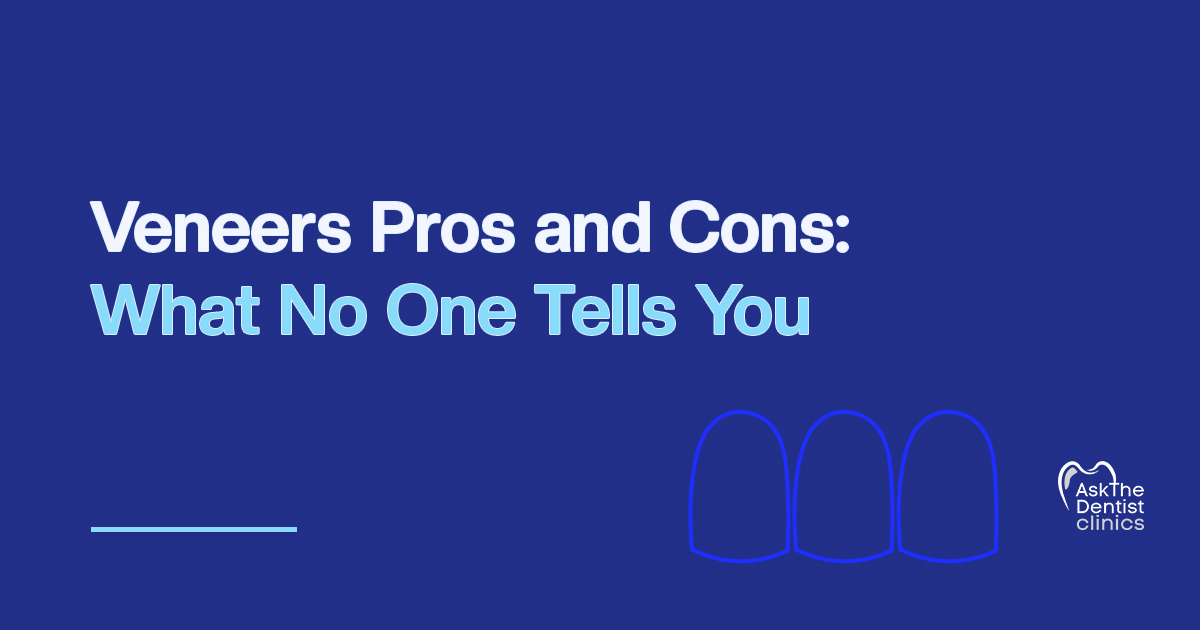 Veneers Pros and Cons: What No One Tells You title card