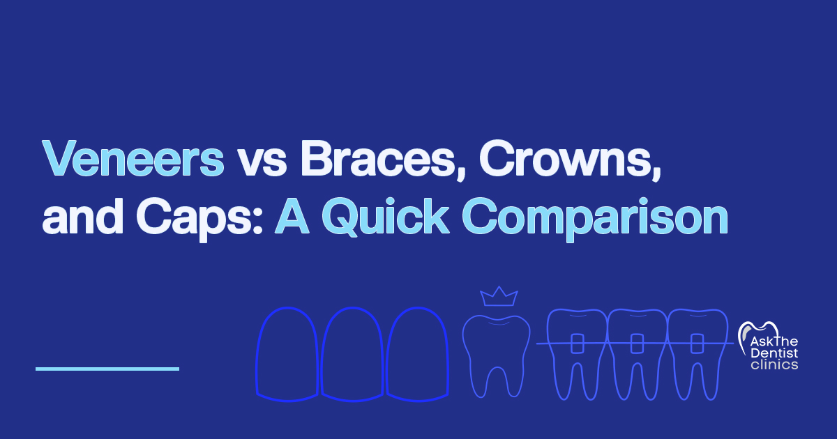 Veneers vs Braces, Crowns, and Caps: A Quick Comparison title card