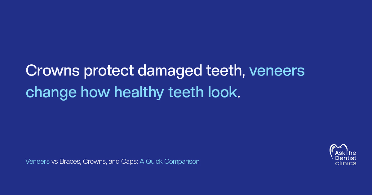 Crowns protect damaged teeth, veneers change how healthy teeth look