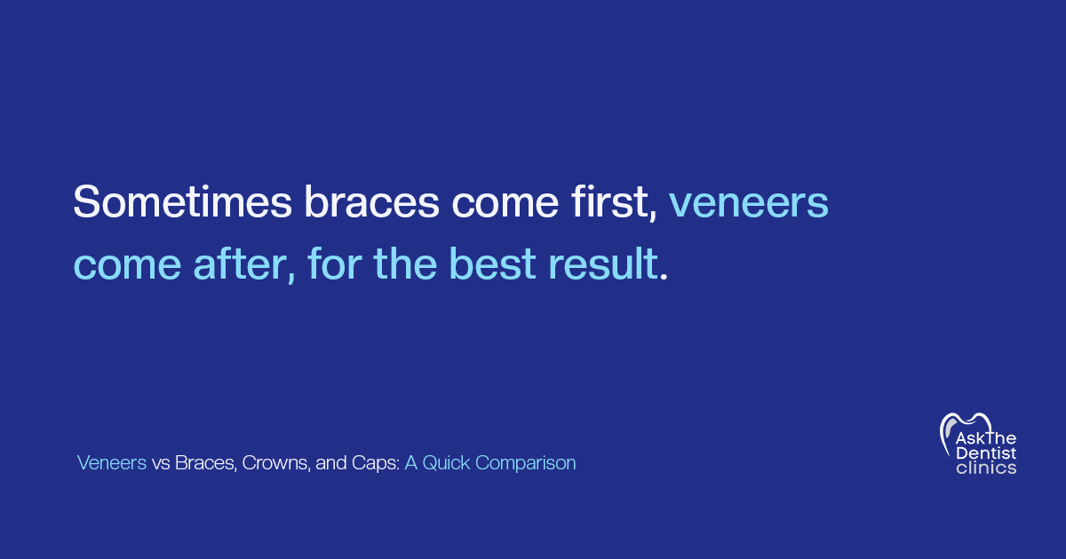 Sometimes braces come first, veneers come after, for the best result
